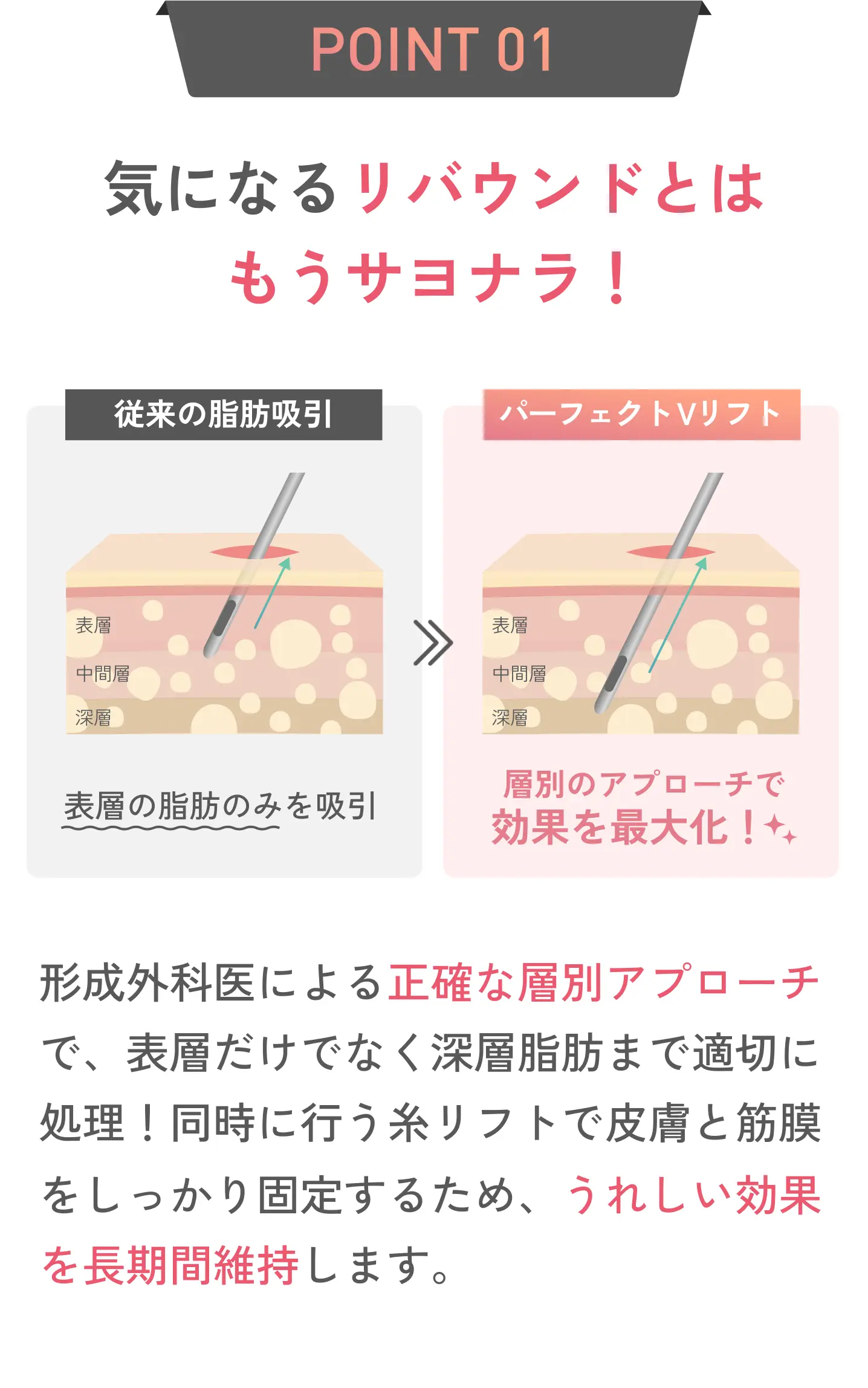 POINT 01 形成外科専門医による正確な層別アプローチで、表層だけでなく深層脂肪まで適切に処理!同時に行う糸リフトで皮膚と筋膜をしっかり固定するため、うれしい効果を長期間維持します。