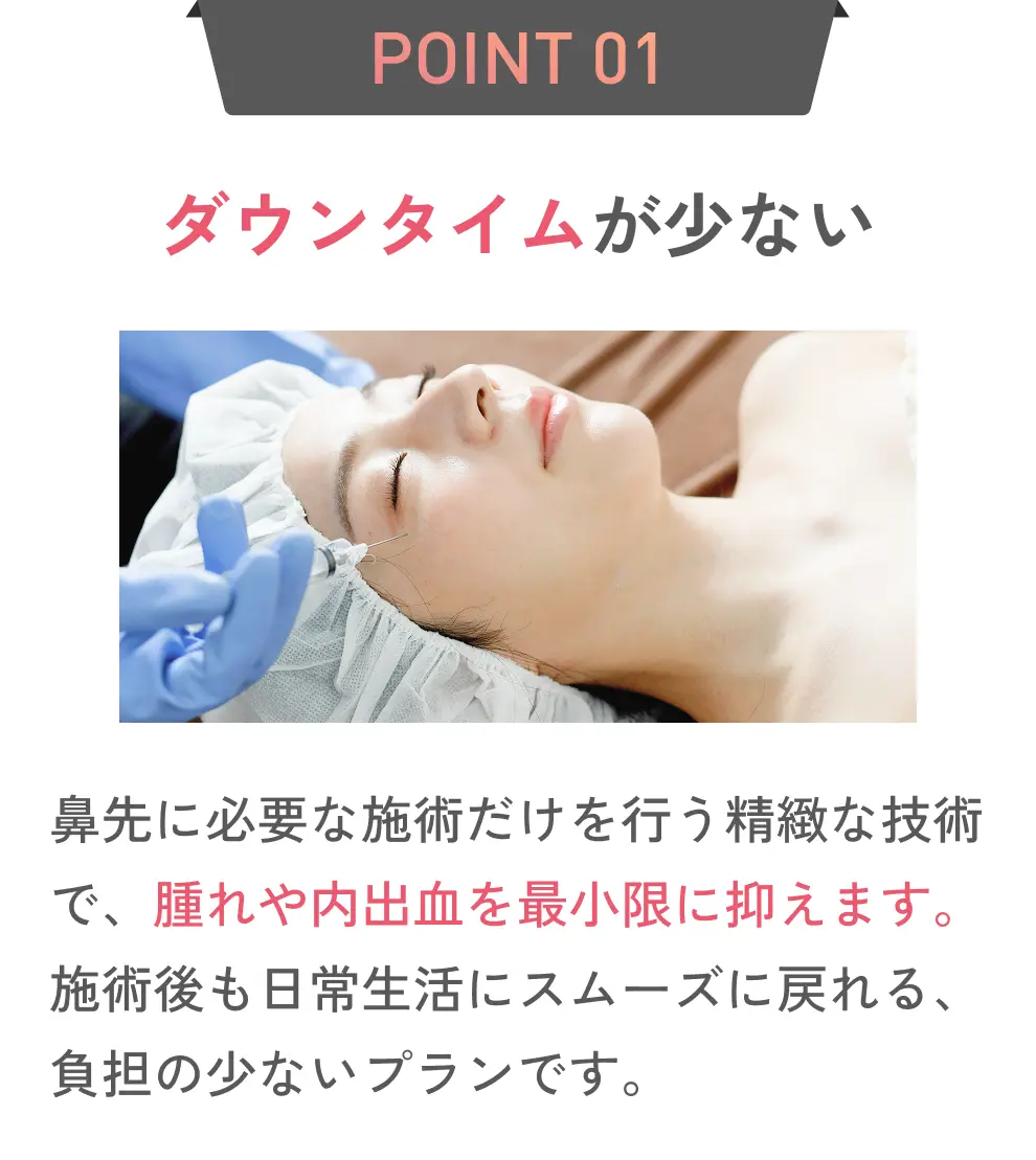 ダウンタイムが少ない
