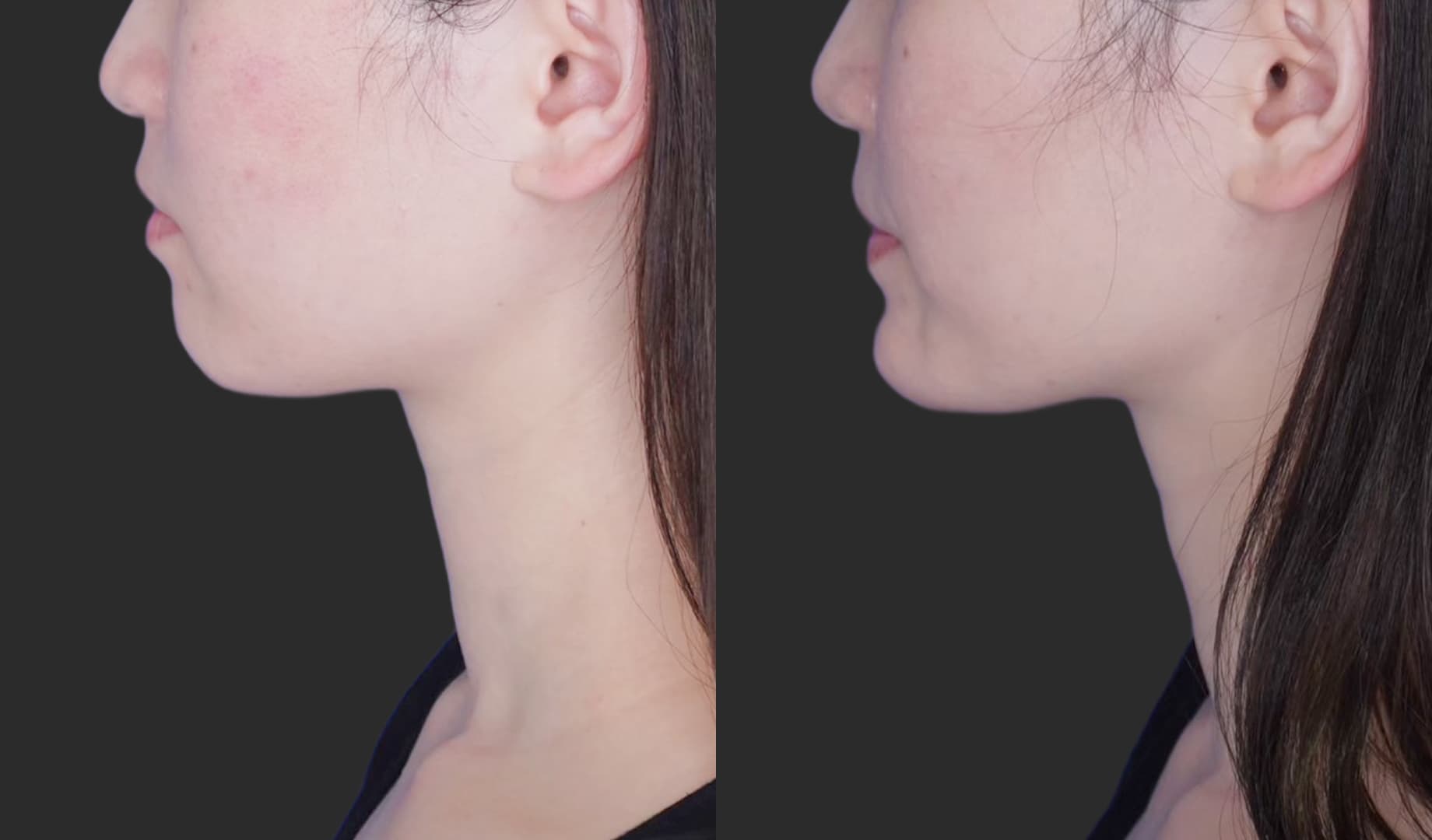 Before After