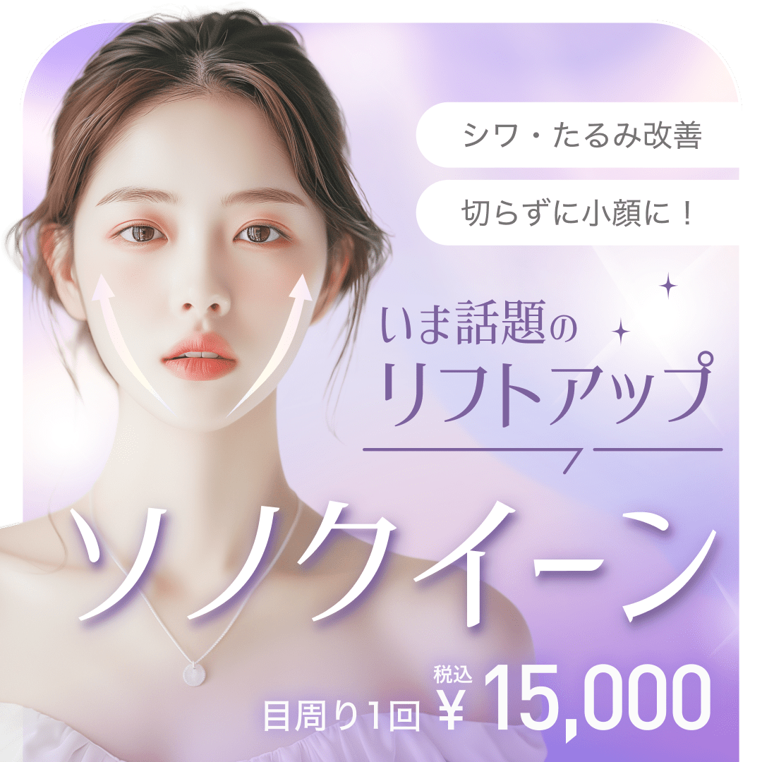 ソノクイーン