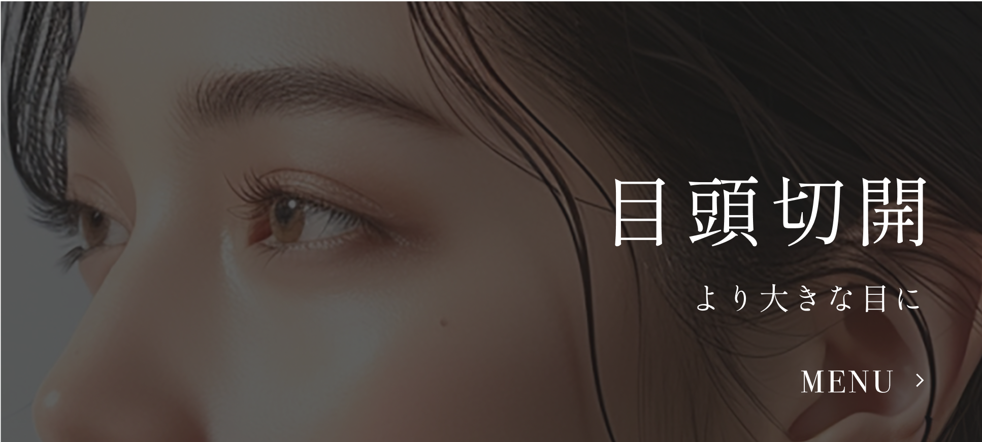 目頭切開