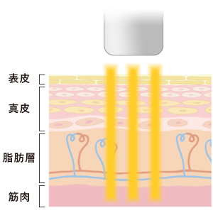 診療メニュー Venus Beauty Clinic 新宿 銀座